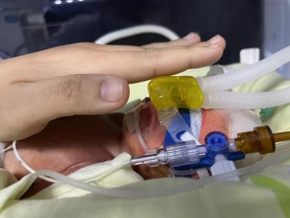 重庆市黔江中心医院 29+周宝宝的出生历险记