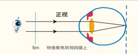 孩子视力检查为什么会测眼轴？湖北普瑞眼科医院专家告诉你