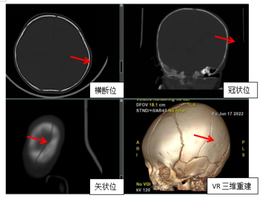 为啥一个部位要做两个检查？是过度医疗吗？事实来了……