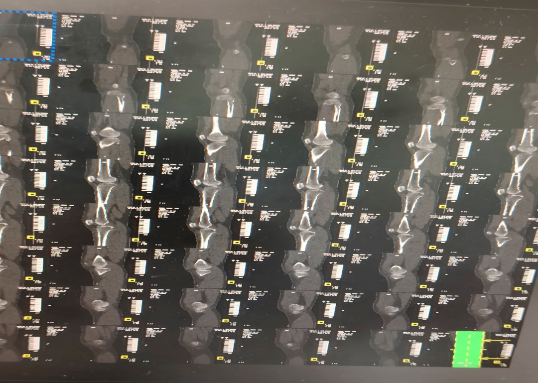 为啥一个部位要做两个检查？是过度医疗吗？事实来了……