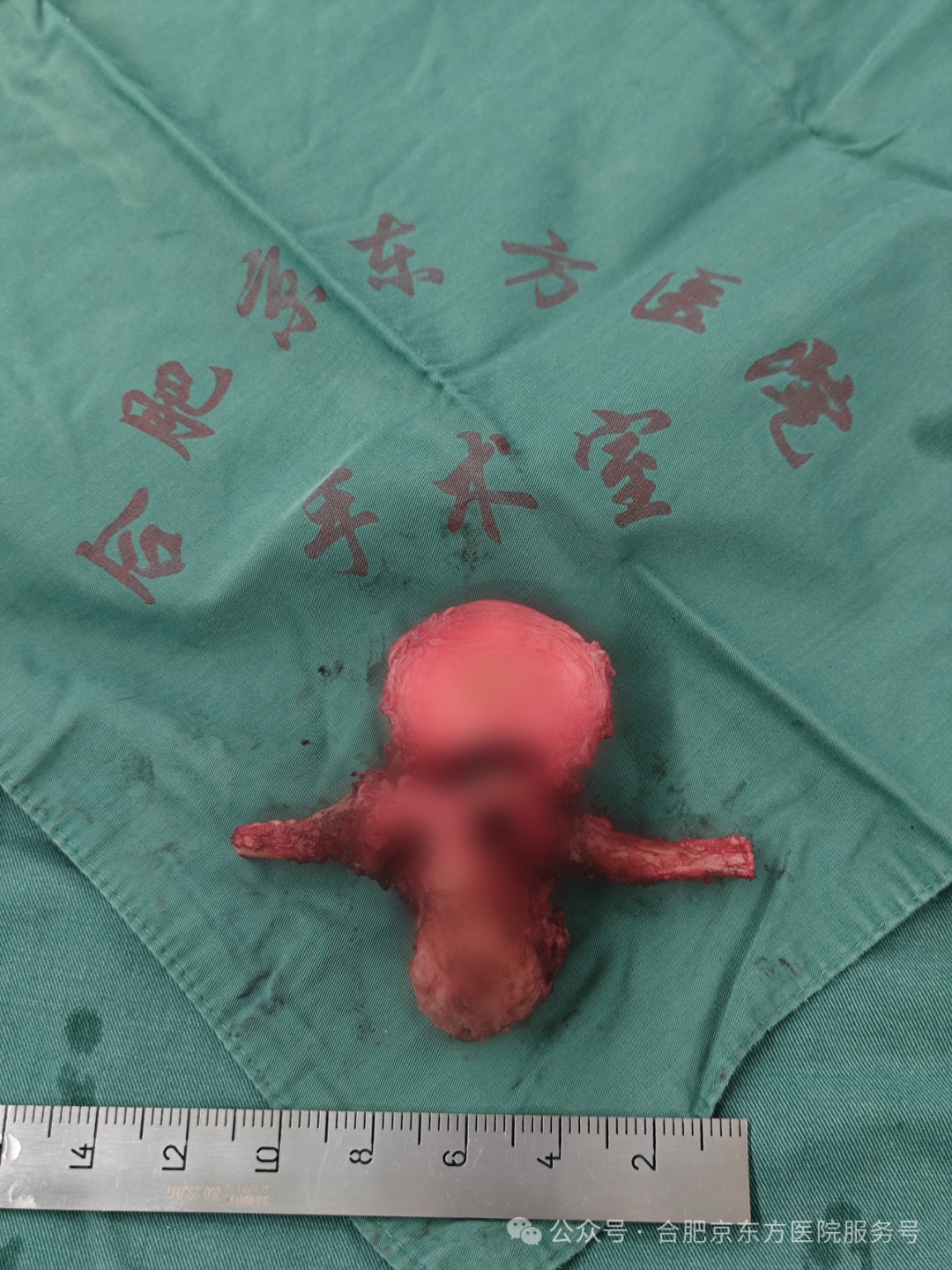 合肥京东方医院：老人腰背痛，查出 2 处癌！这种疼痛要警惕！