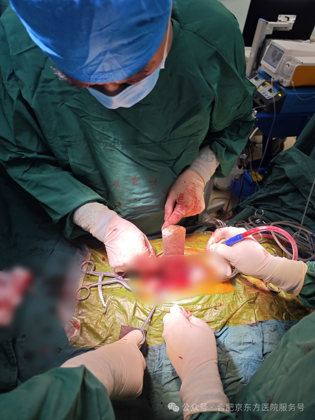 合肥京东方医院：老人腰背痛，查出 2 处癌！这种疼痛要警惕！