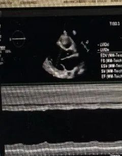 年轻小伙戴着他的一颗「中国心」回家过年