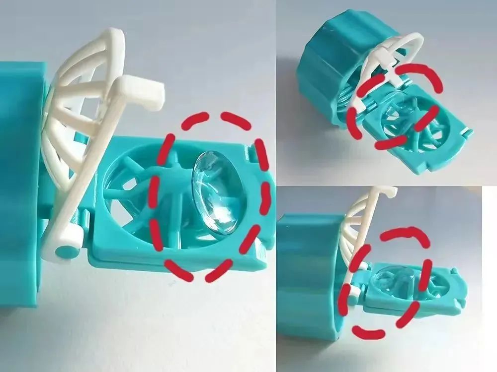 OK 镜冬季保养指南——快来看看如何有效避免 OK 镜碎片吧