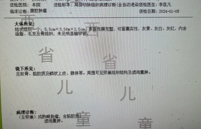 躲在肚子里的「小怪兽」一一儿童畸胎瘤
