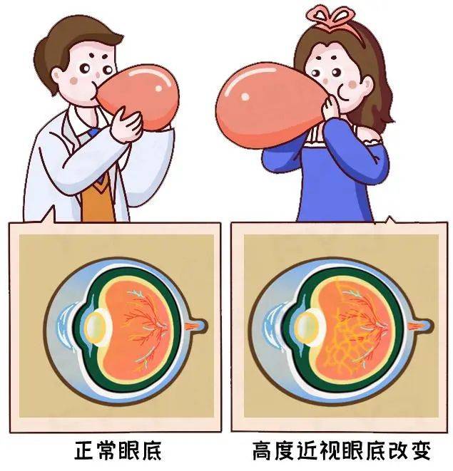 预防孩子近视，爸爸妈妈能做些什么？湖北普瑞眼科医院为你解答