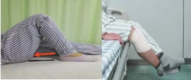 「快速康复理念」在膝关节置换术后的重要性