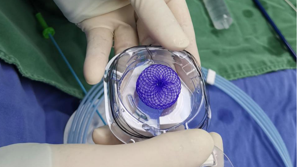 常州市第二人民医院成功开展生物可降解卵圆孔未闭封堵器植入术