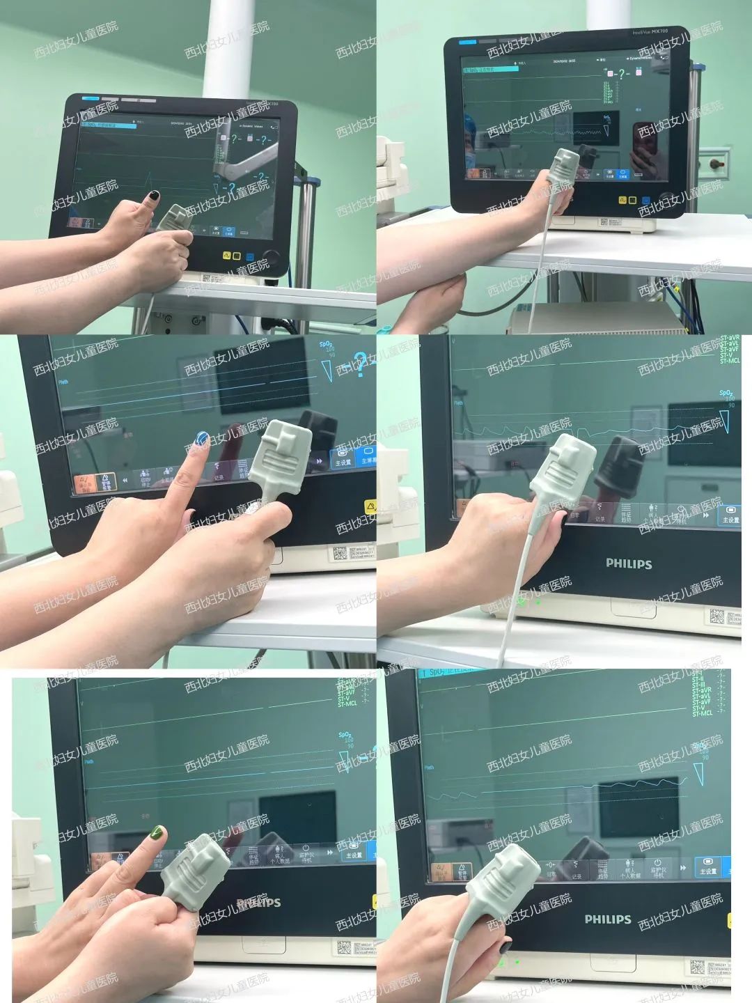 女子看个病，「指甲」被卸掉！这是什么奇葩规定？