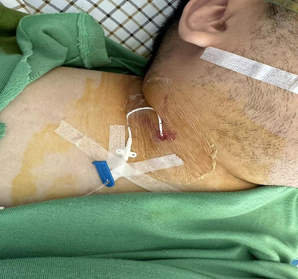 赤诚谱青春，奋斗铸使命——记奔跑在一线的台州市肿瘤医院麻醉人