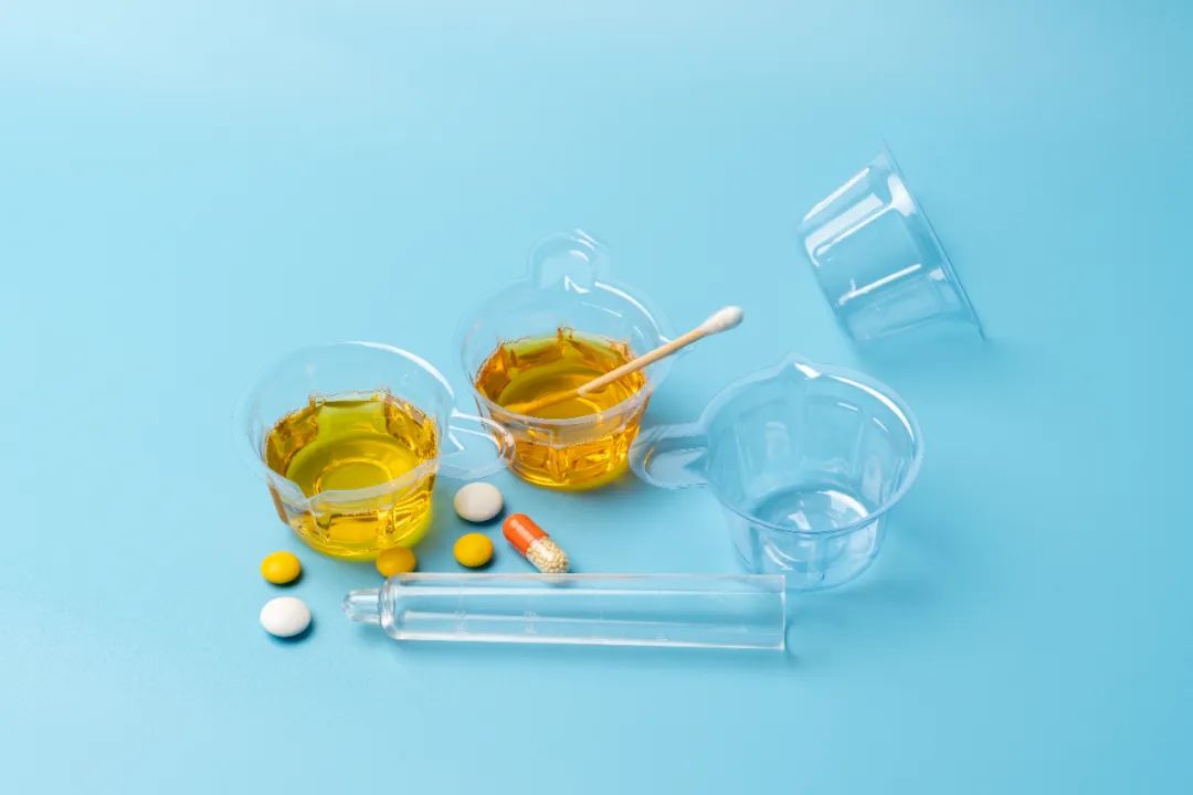 别担心！体检报告的这些异常，可能是虚惊一场！