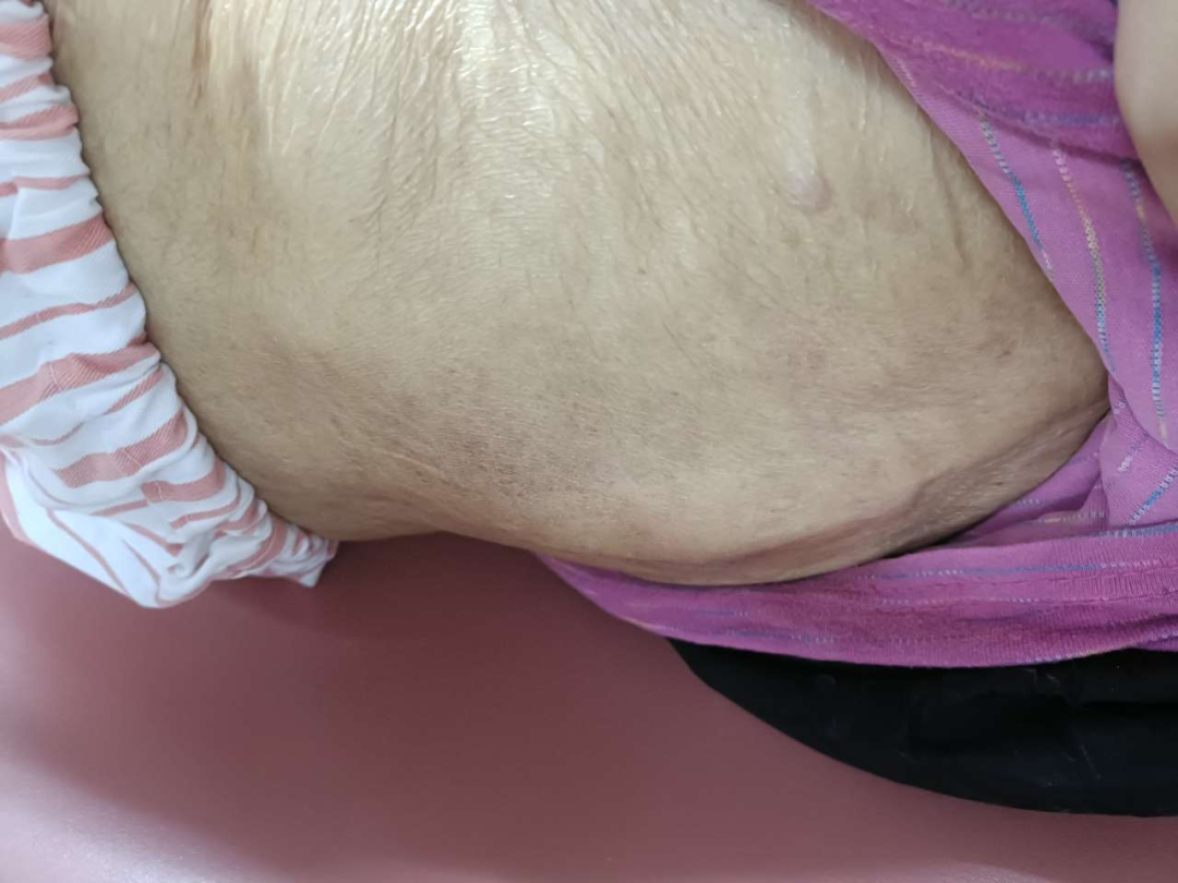 赤诚谱青春，奋斗铸使命——记奔跑在一线的台州市肿瘤医院麻醉人