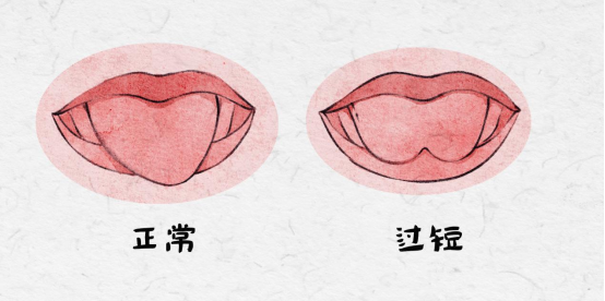 关注急性乳腺炎,如何远离哺乳之「痛」