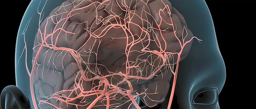 一旦破裂，致死率极高！警惕脑内的「不定时炸弹」……