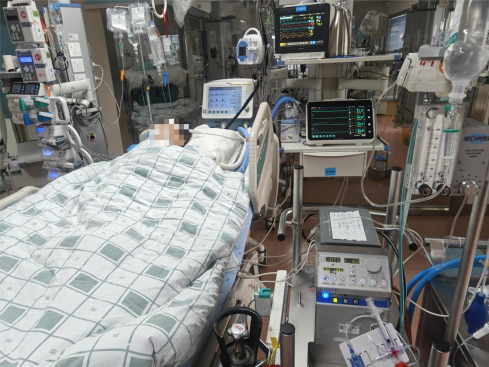 高级生命支持在 ICU：艰难的挑战与创新之路
