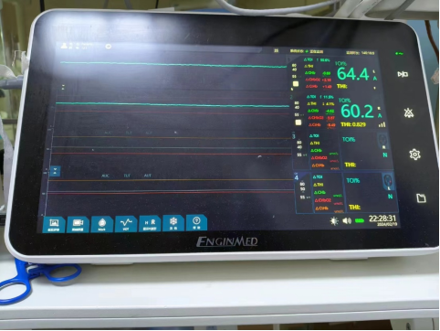 高级生命支持在 ICU：艰难的挑战与创新之路