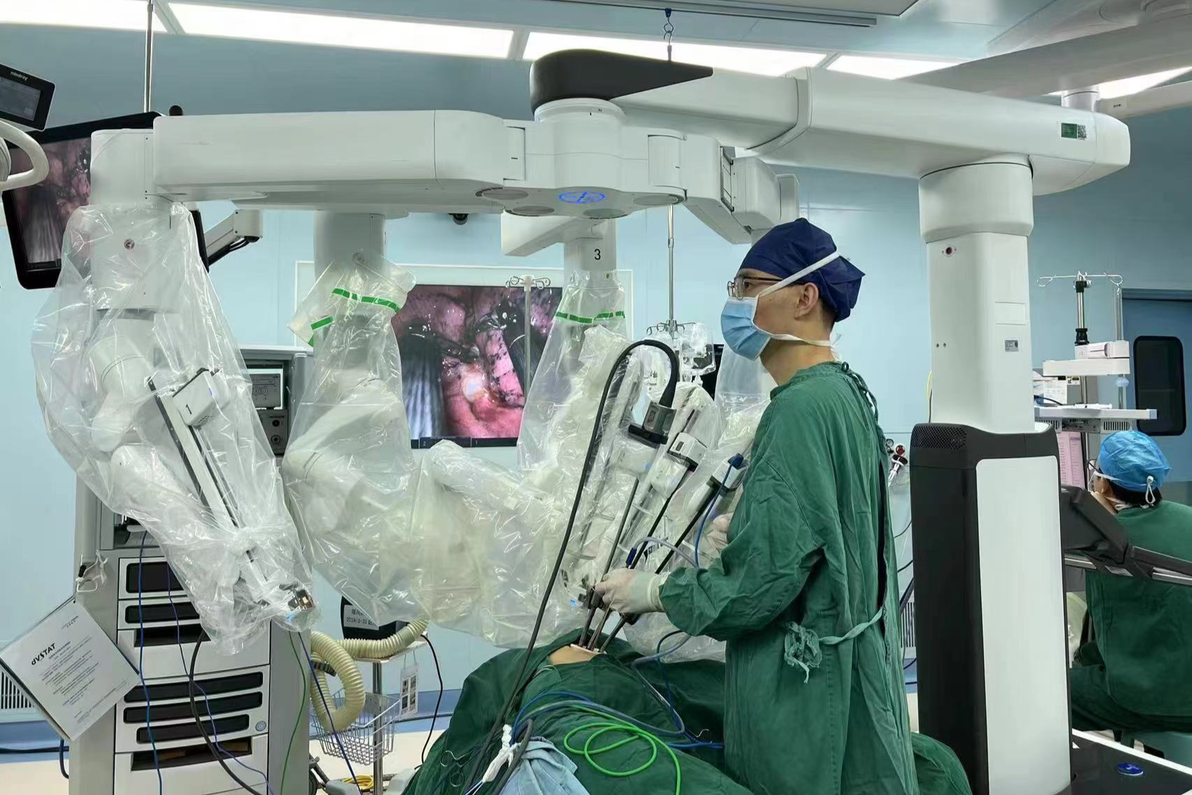 自治区南溪山医院胸外科完成广西首例单孔「达芬奇」机器人辅助肺叶切除术
