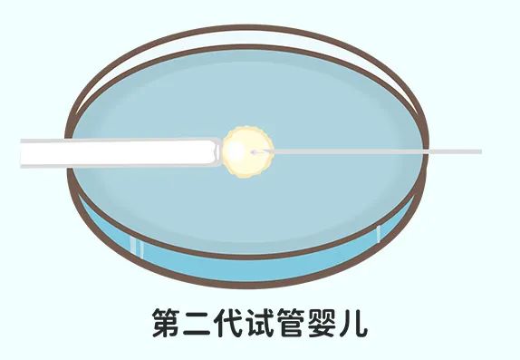 试管婴儿怎么做？江湾给你全攻略！