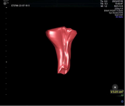 备孕总不成功，可能是「土壤贫瘠」的缘故