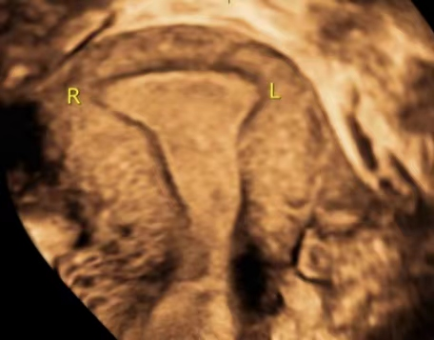 备孕总不成功，可能是「土壤贫瘠」的缘故