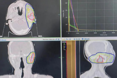 承德县医院精准放疗「狙击」肿瘤，帮助高龄复杂癌症患者重拾生活希望