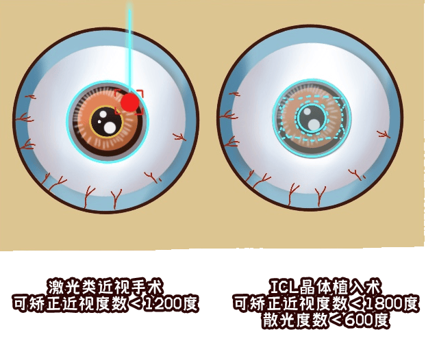 那么多黑科技，有逆转近视的吗？湖北普瑞眼科医院解答