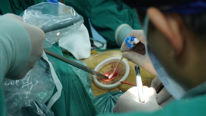 新突破！南昌大学二附院完成一例单孔胸腔镜下心脏肿瘤切除术