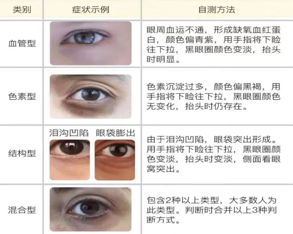 每天睡够几小时，才能让黑眼圈消失