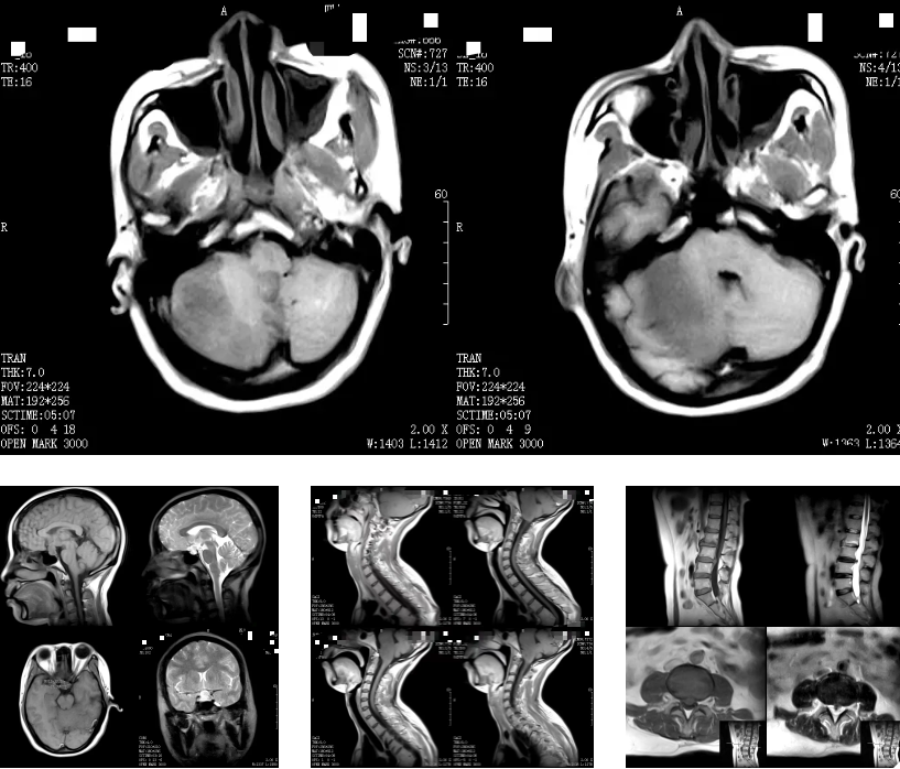 成都誉美医院开展「磁共振（MRI）基本原理和临床应用」专题培训