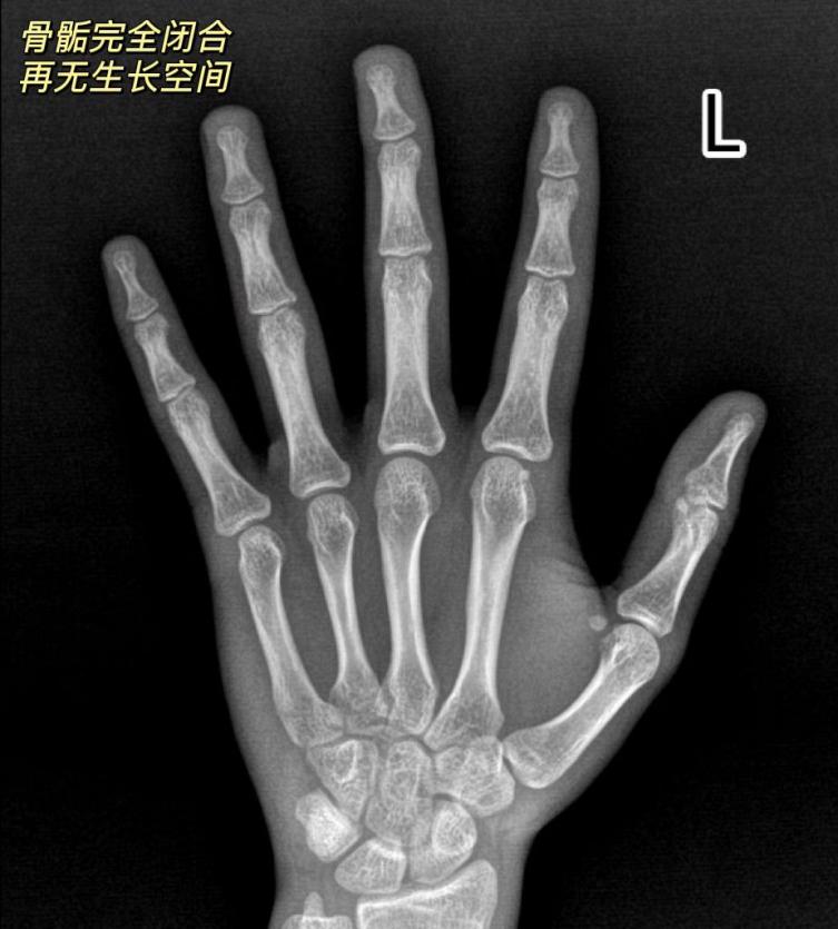 这件事家长不重视 小心孩子越长越矮！