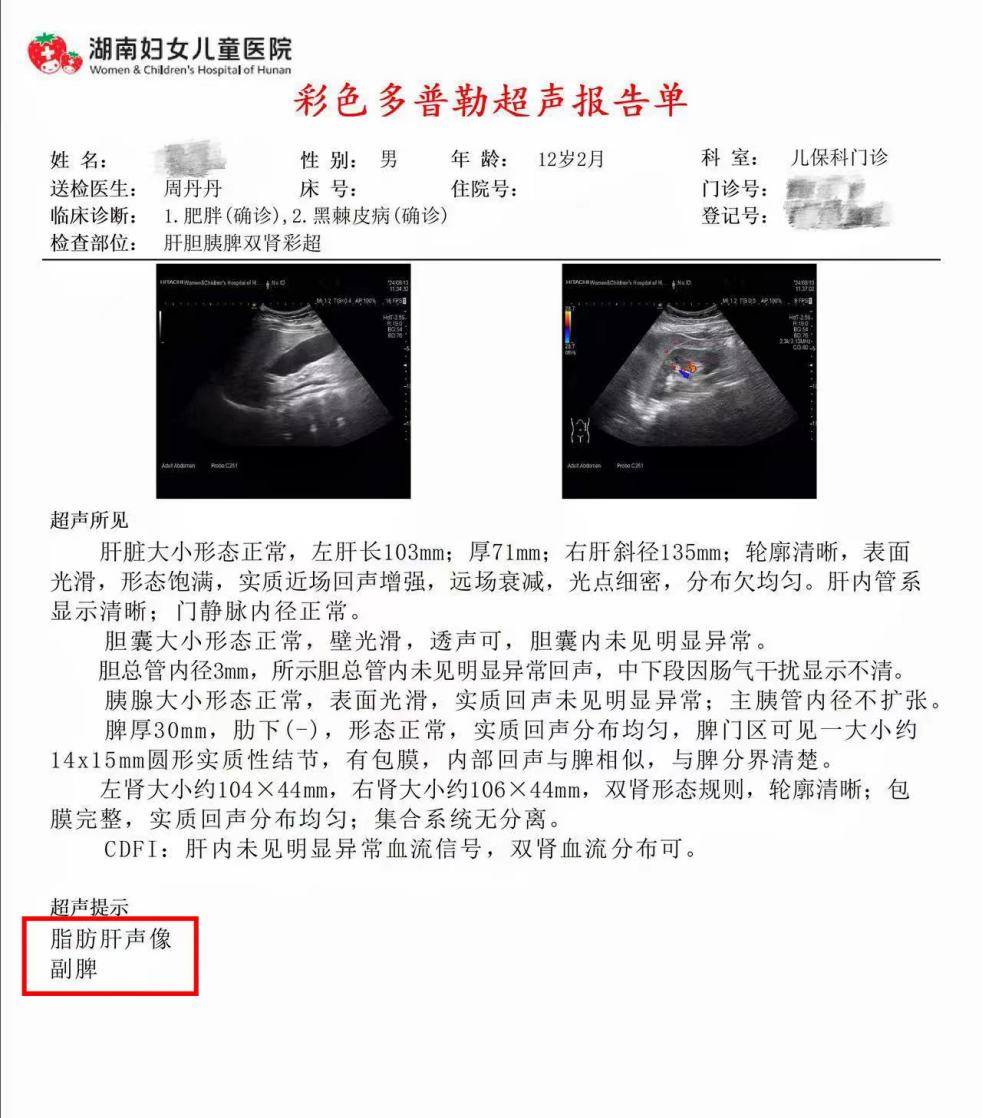 孩子皮肤黑你还单纯以为是晒太阳?出现这种情况要警惕「儿童肥胖」!