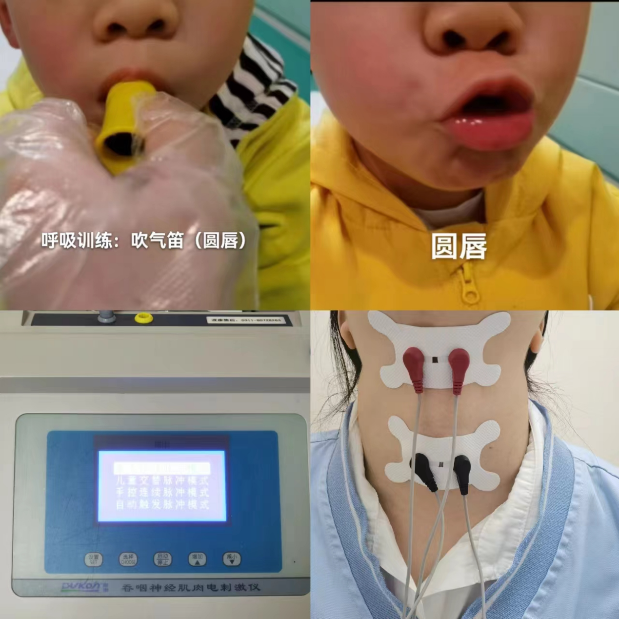 孩子话说不清楚,还觉得小奶音可爱?家长要警惕!可能是构音障碍