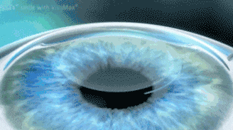 近视手术是否会损伤视网膜？湖北普瑞眼科医院为你解答