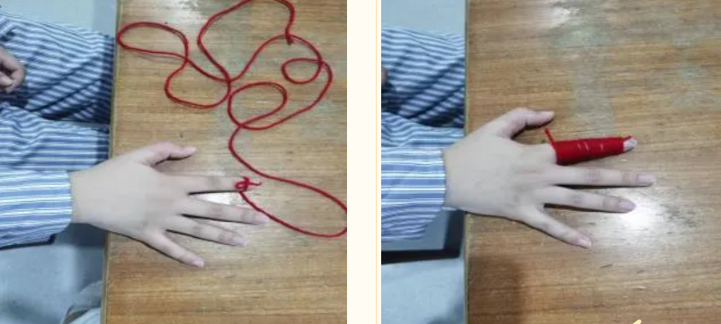 脑卒中后的「大胖手」你处理了吗？