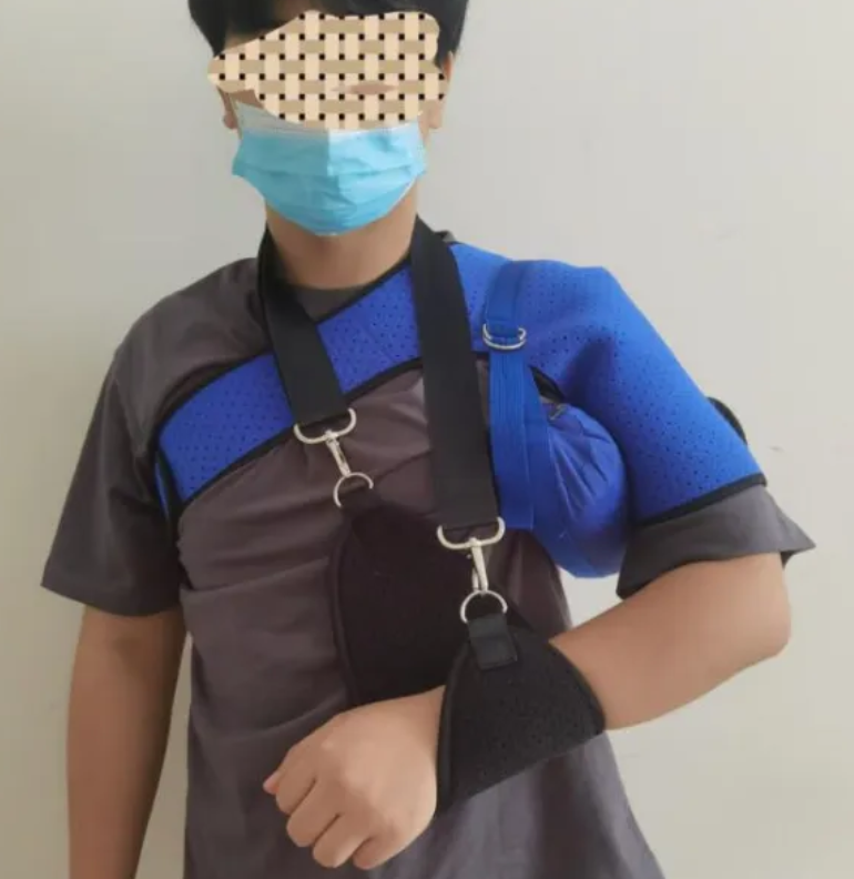 脑卒中后的「大胖手」你处理了吗？