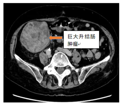 燕达医院普外科杜俊东图片