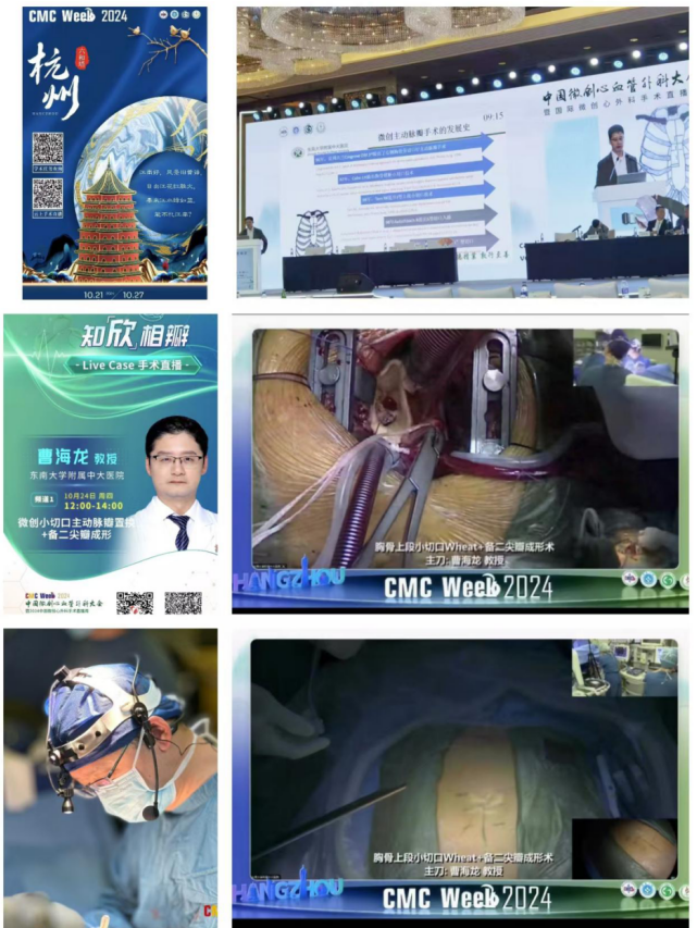中大医院曹海龙主任团队精彩亮相省及全国学术会议