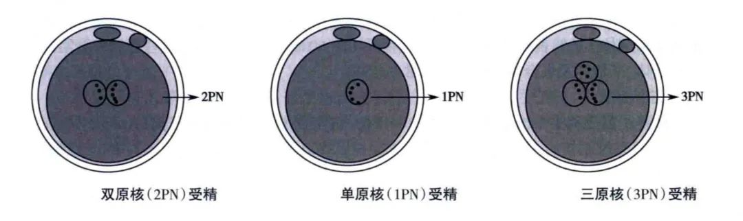【江湾试管百科】什么是正常受精和异常受精?
