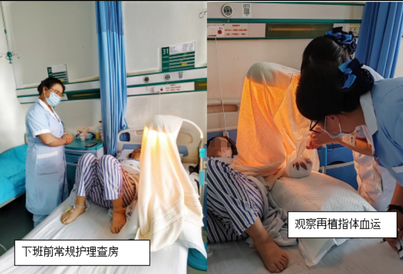 多手指离断再植术后护理体会