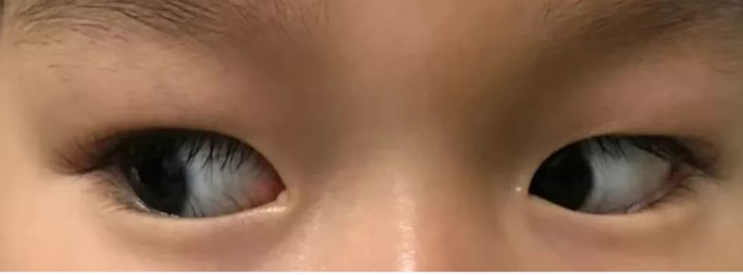 关于 「眼睛上的小刷子」，你知道多少