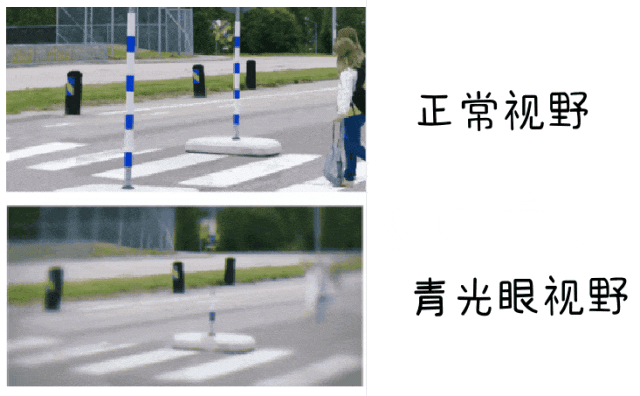 长时间关灯玩手机,小心青光眼!