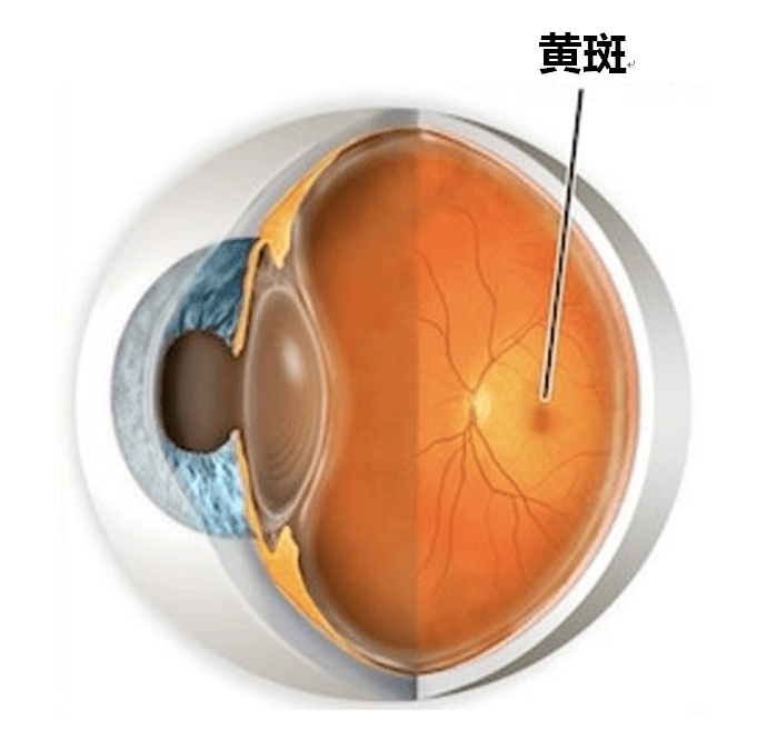 湖北普瑞眼科医院|什么是老年性黄斑变性?怎么预防?