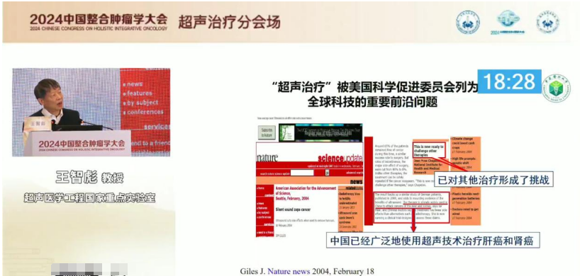 王智彪教授在 2024 中国整合肿瘤学大会畅谈高强度聚焦超声一个颠覆性的前沿性技术
