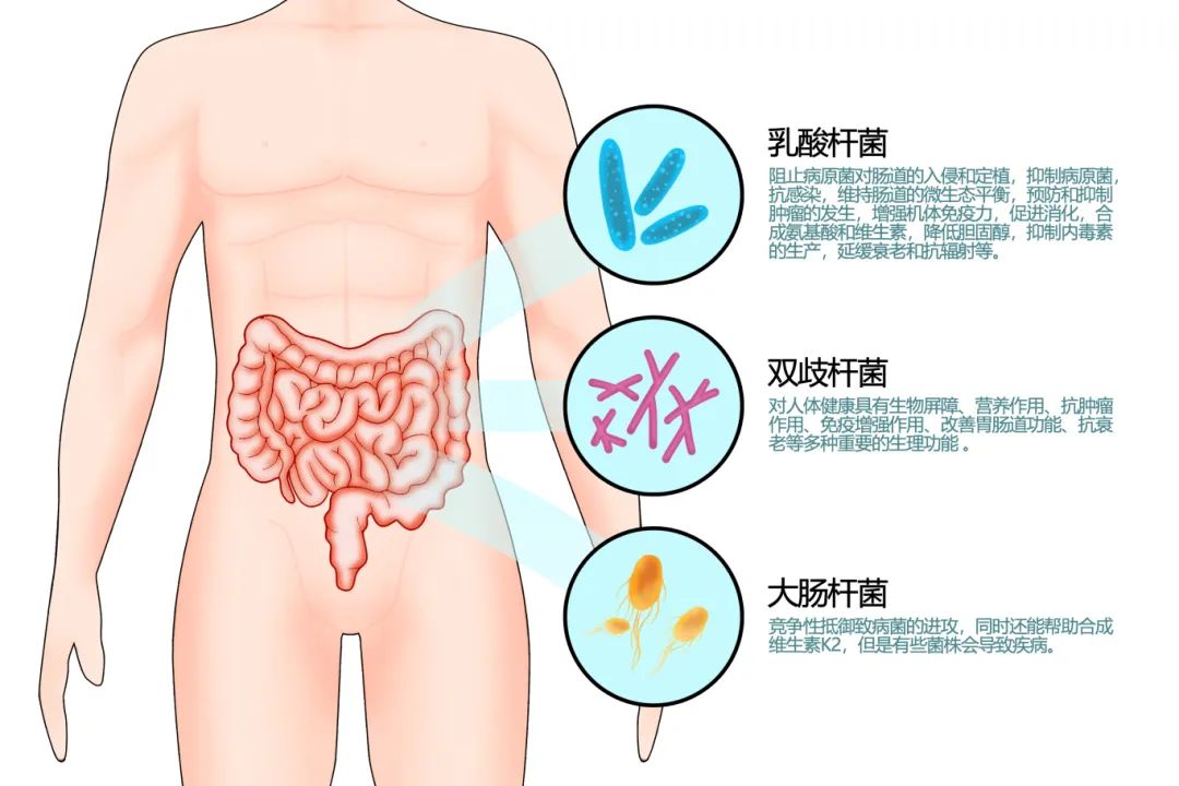 顽固性便秘多年，已弃疗？试试肠道菌群移植「新方法」