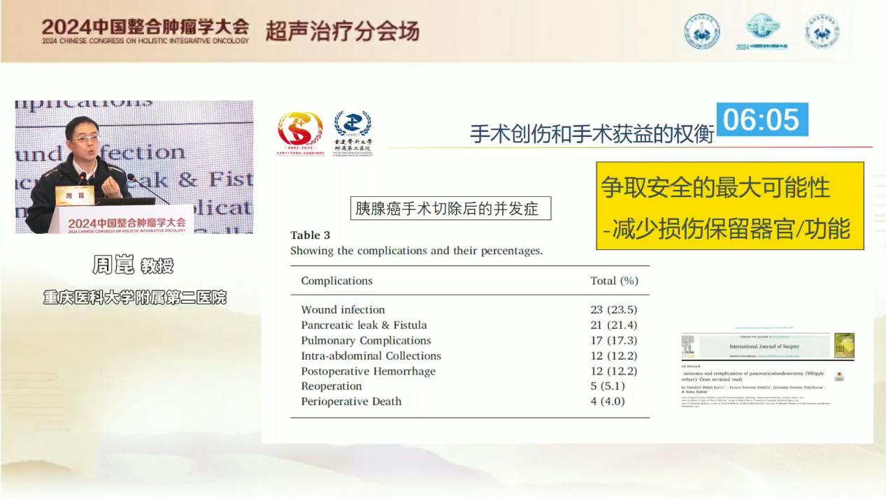 重医附二院周崑教授：高强度聚焦超声技术在恶性肿瘤的临床应用