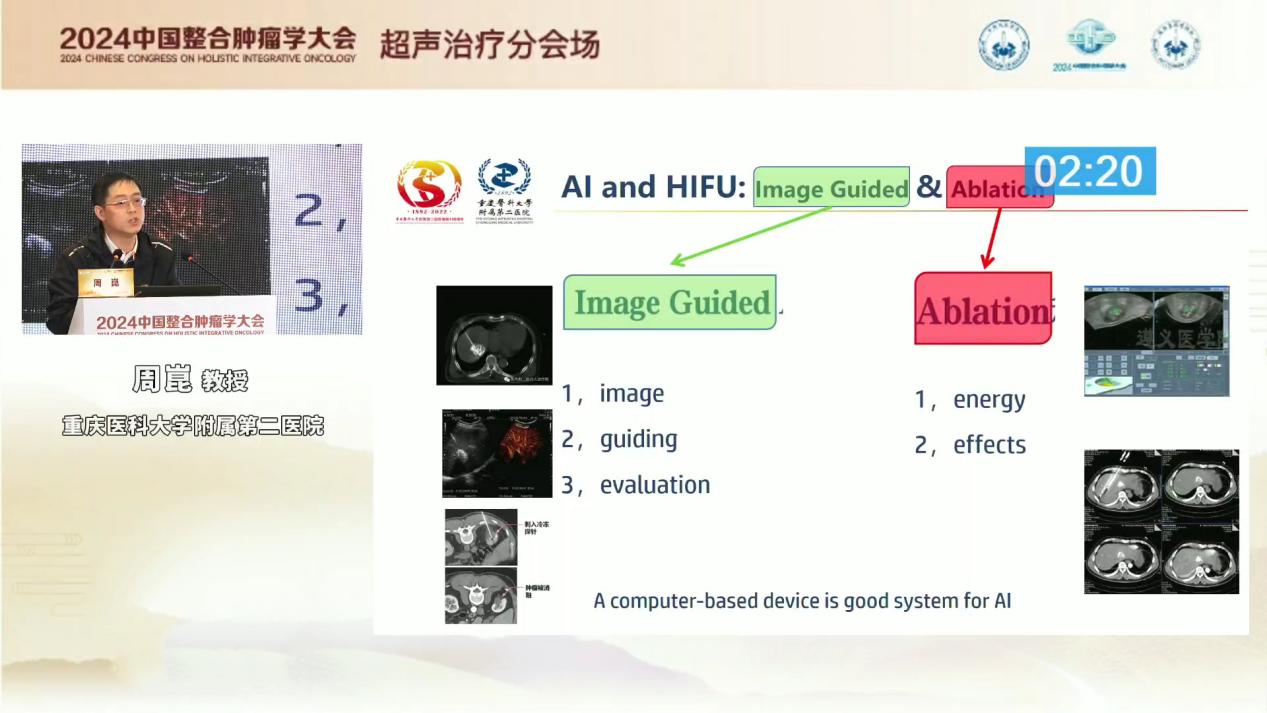 重医附二院周崑教授：高强度聚焦超声技术在恶性肿瘤的临床应用