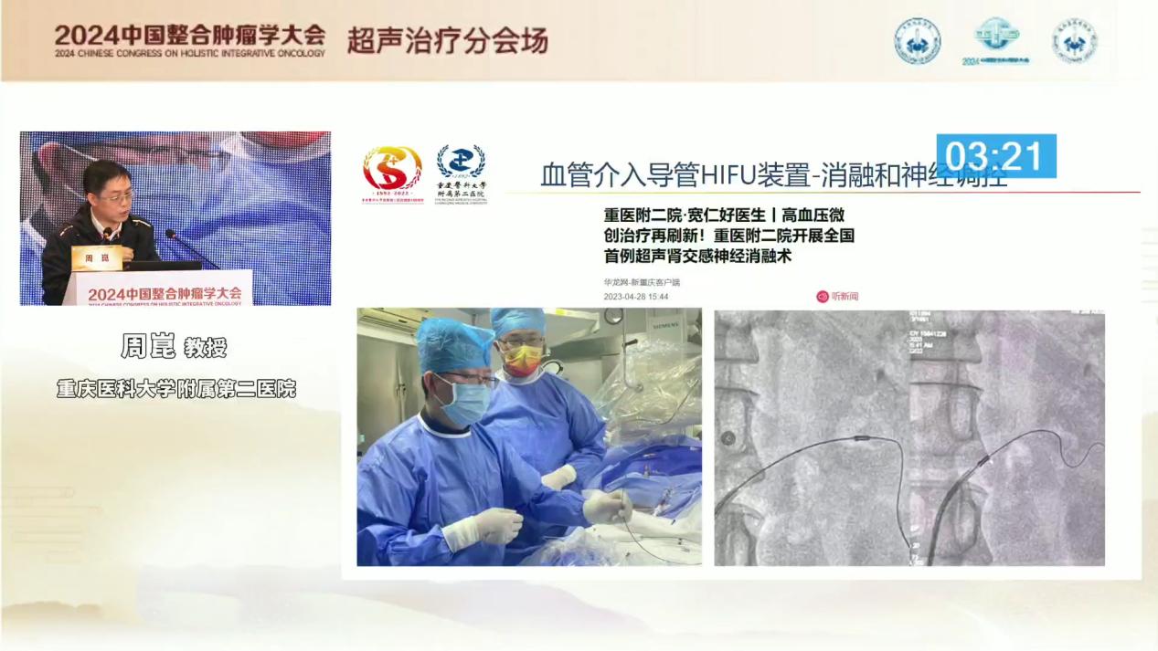 重医附二院周崑教授：高强度聚焦超声技术在恶性肿瘤的临床应用