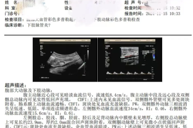 陕北首例！延大附院 MDT 协作让跛行四载患者重获正常行走能力