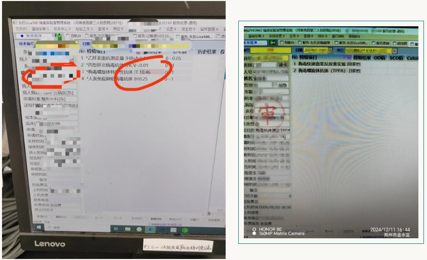 爱美查出有「梅」？梅毒抗体阳性一定是梅毒吗？