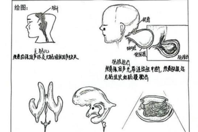 记郑大五附院超声医学科专业基地教学方法之「手绘解剖图」